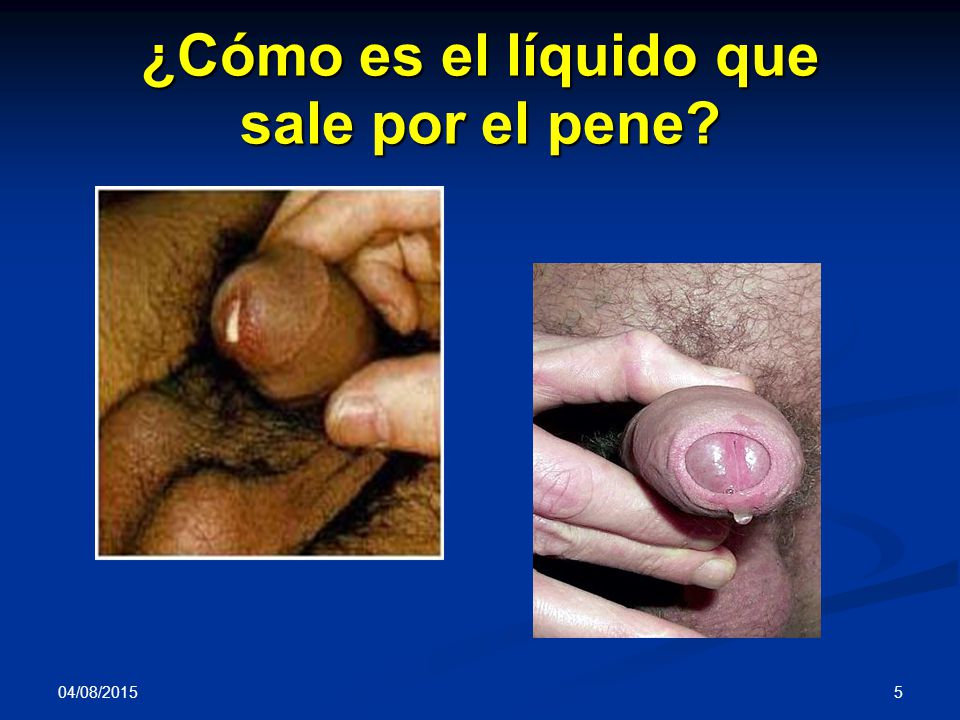 Verdoso pene liquido del